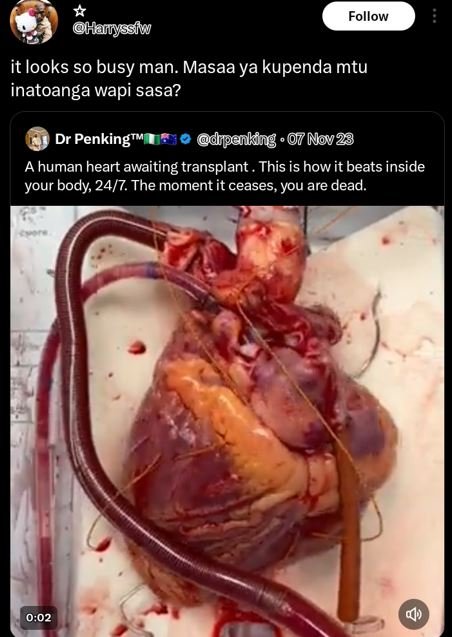 Follow hairyssiw it looks so busy man. masaa ya kupenda mtu inatoanga wapi sasa?