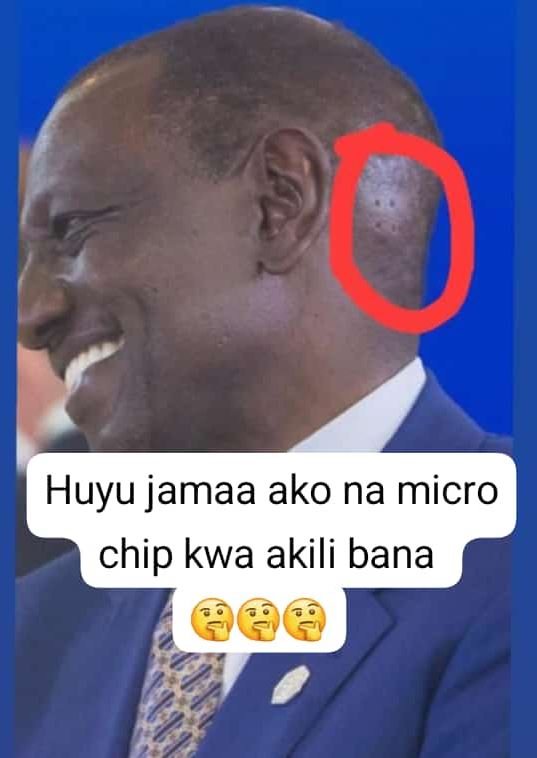 0 huyu jamaa ako na micro chip kwa akili bana