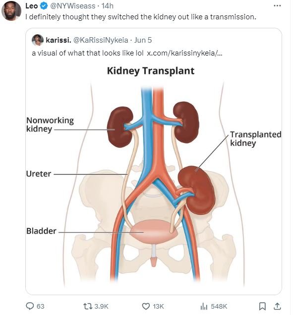 Leo nywiseass 14h idefinitely thought they switched the kidney out like transmis