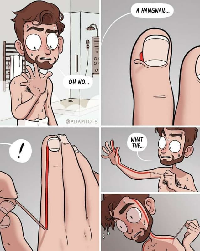 Hangnail. oh no. adamtots what the