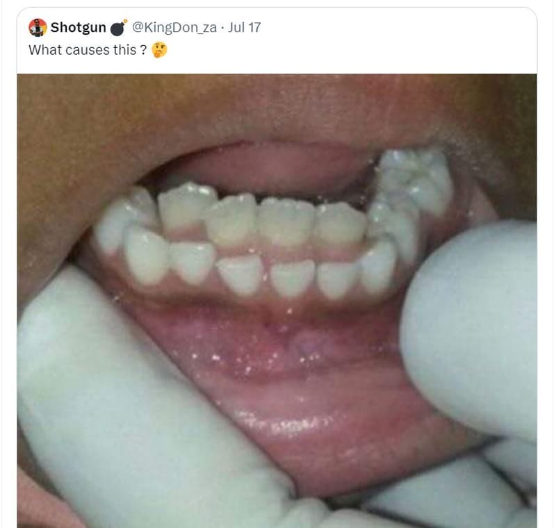 Shotgun kingdon_za jul 17 what causes this ?