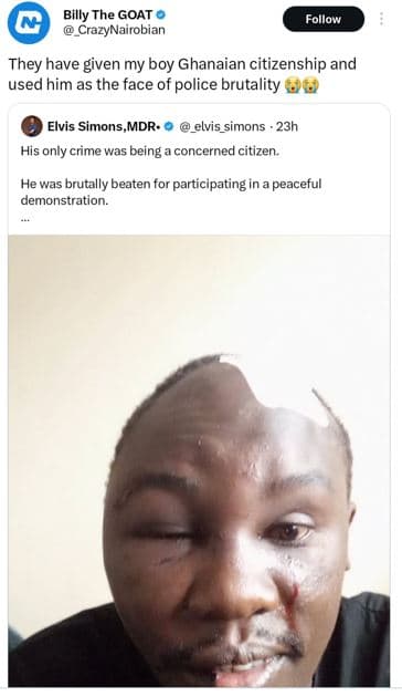 Billy the goat crazynairobian follow they have given my boy ghanaian citizenship