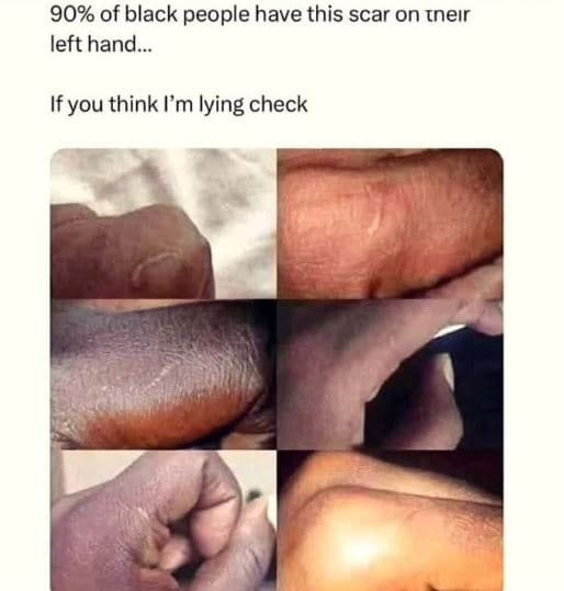 90 of black people have this scar on rneır left hand. if you think lm iying chec