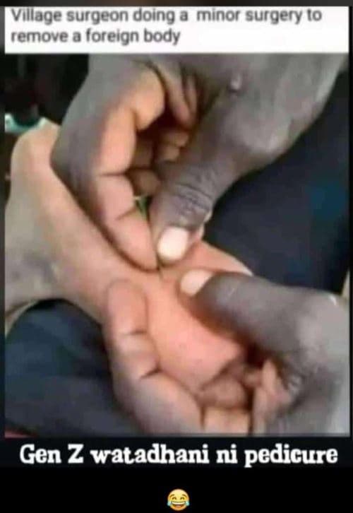 Village surgeon doing 0 minor surgery i0 remove 0 foreign body gen z watadhani n